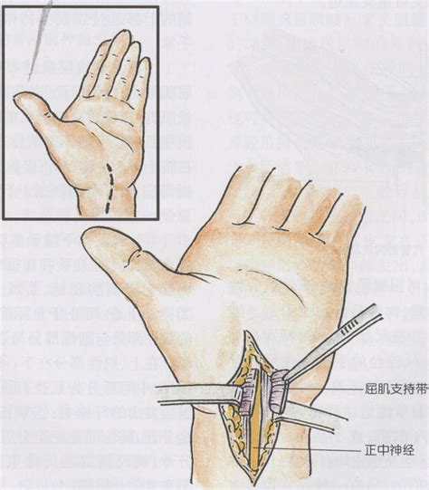 左手是哪里